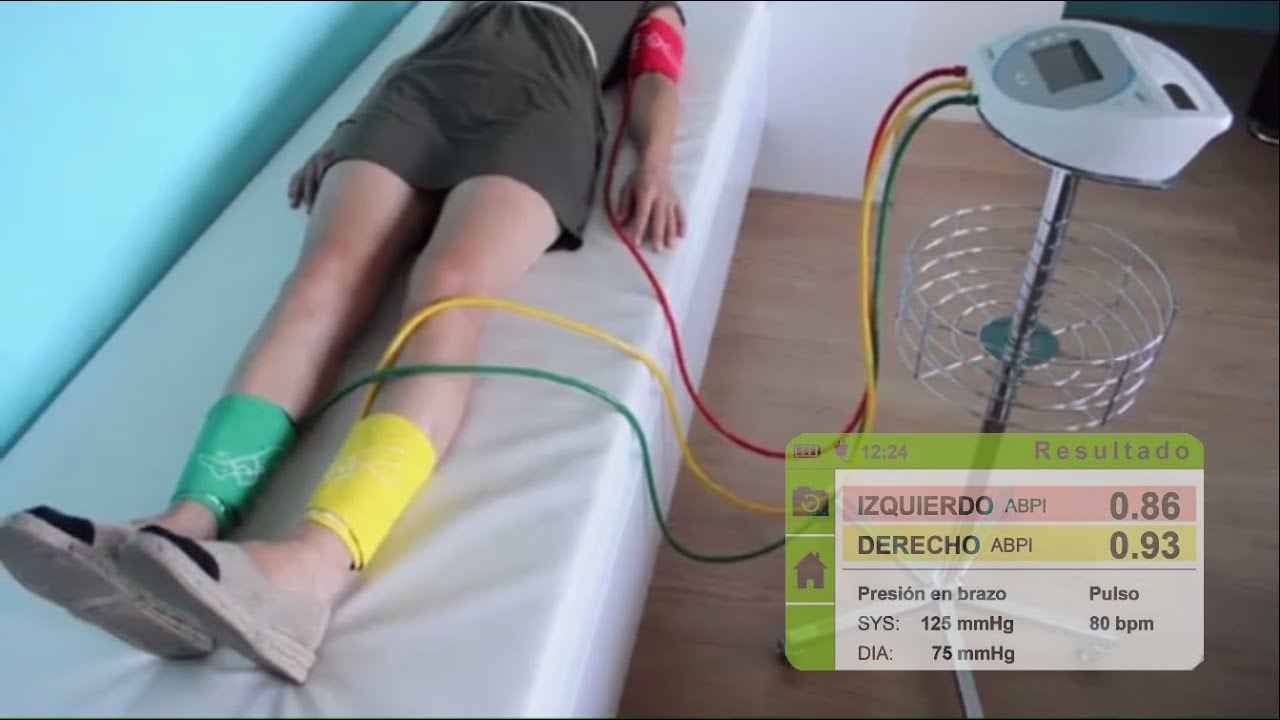 Indice Tobillo-Brazo con MESI ABPI MD