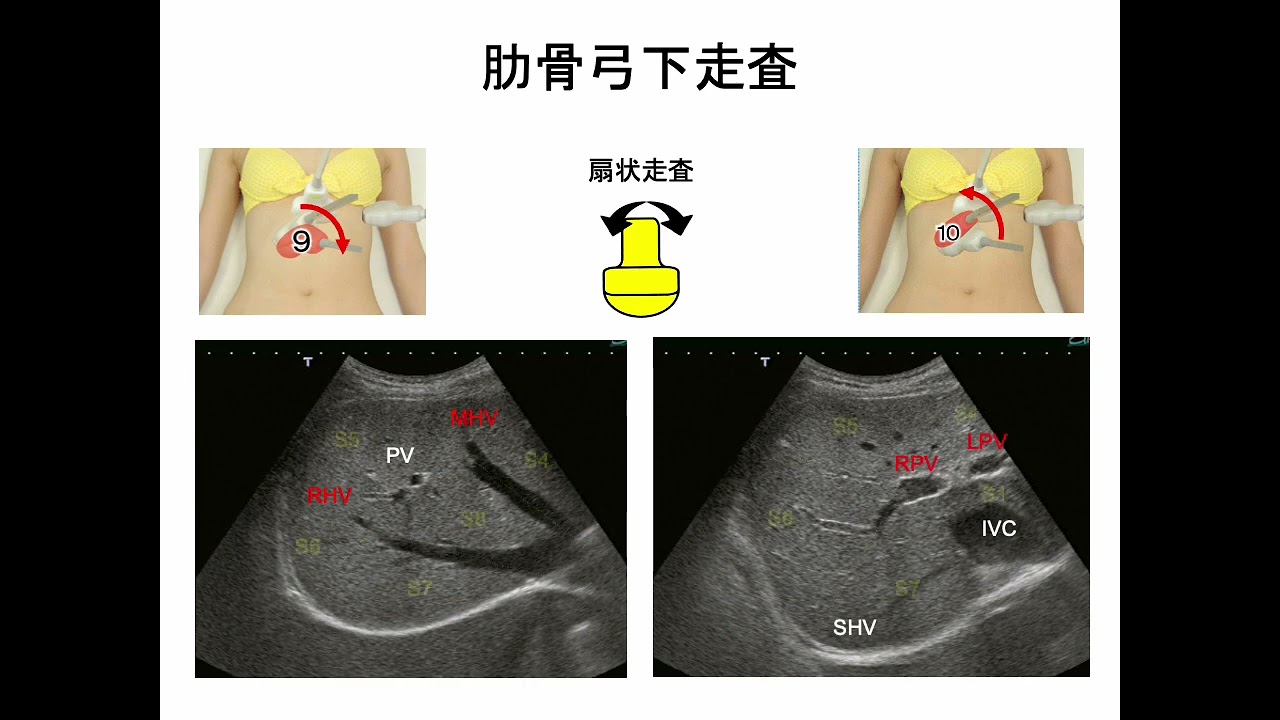 公開用ラダーコンテンツ 超音波検査　肝臓 泌尿器系 婦人科領域