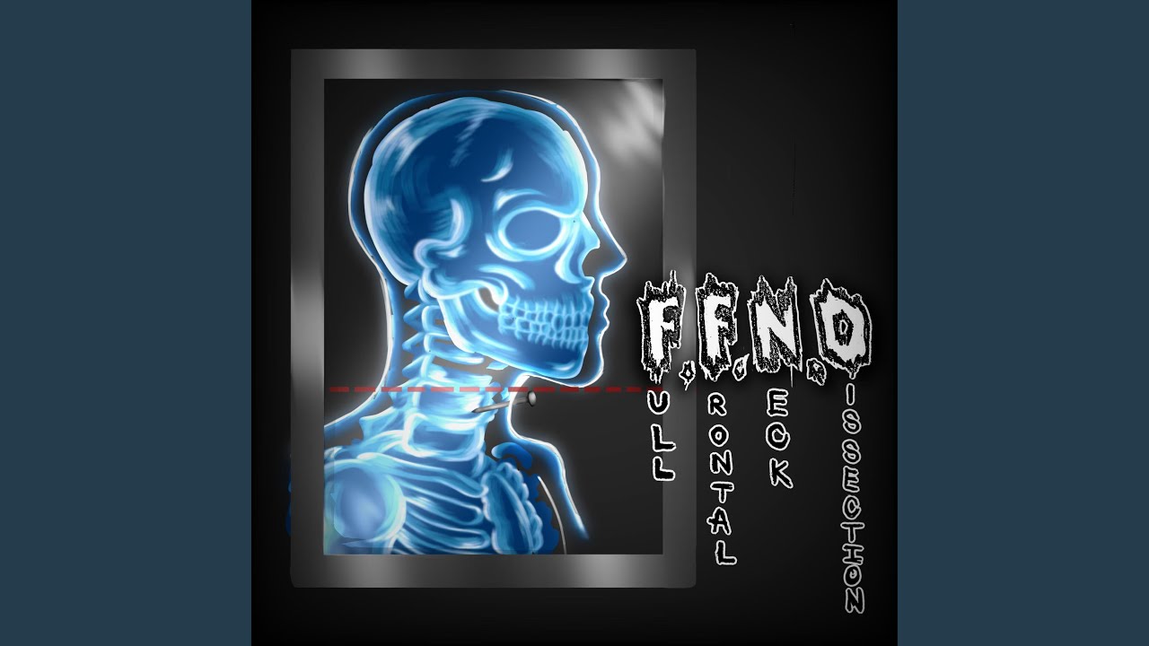 Full Frontal Neck Dissection