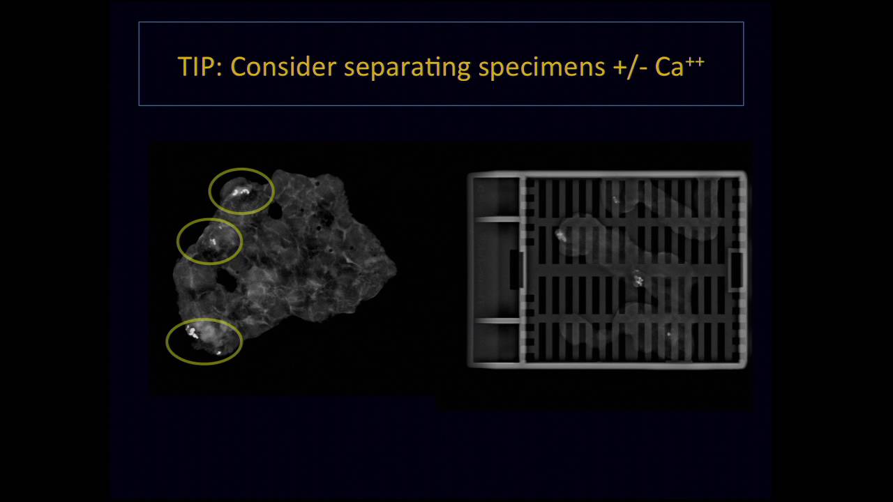 Breast Imaging:  Radiology-Pathology Correlation – Lori Strachowski, MD
