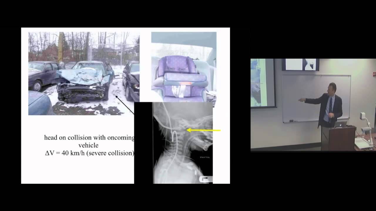 Road Traffic Injury Among Children