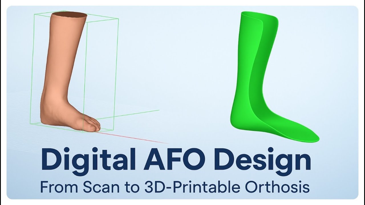 Complete Digital AFO Design Workflow | From Scan to 3D-Printable Orthosis