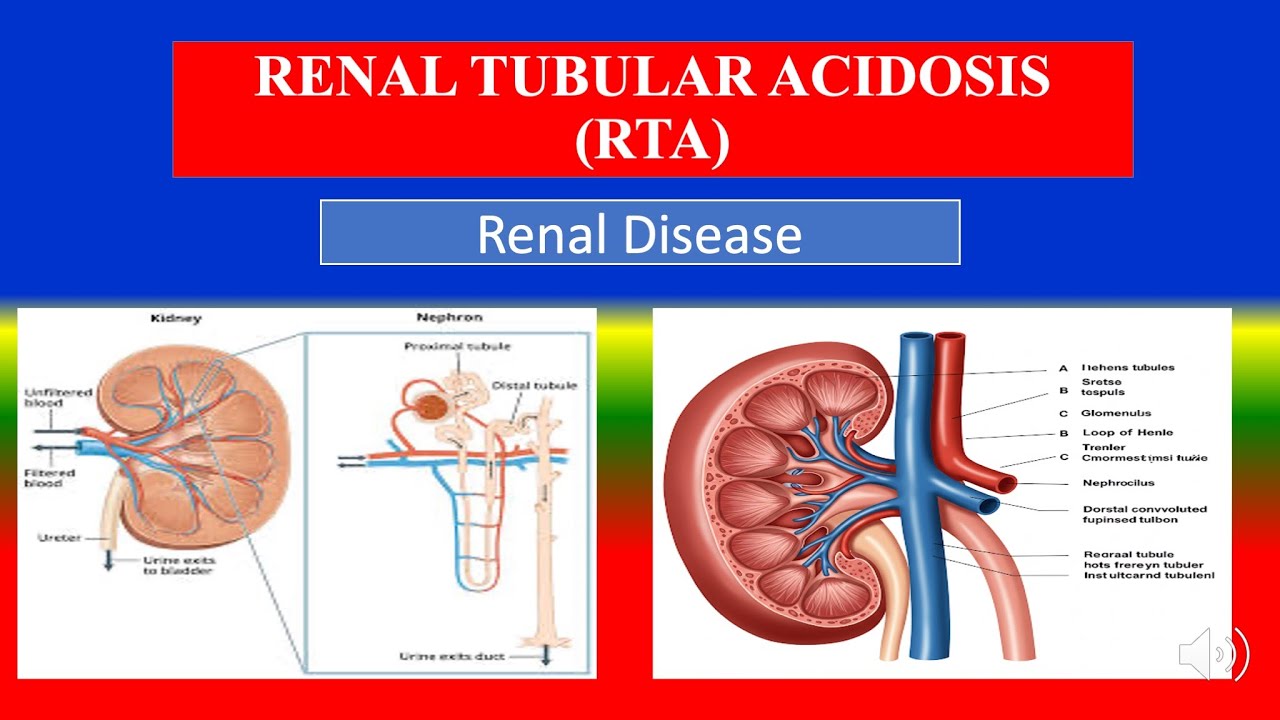 RENAL TUBULAR ACIDOSIS (RTA) - Definition, types, causes, pathophysiology,diagnoses ,medicine
