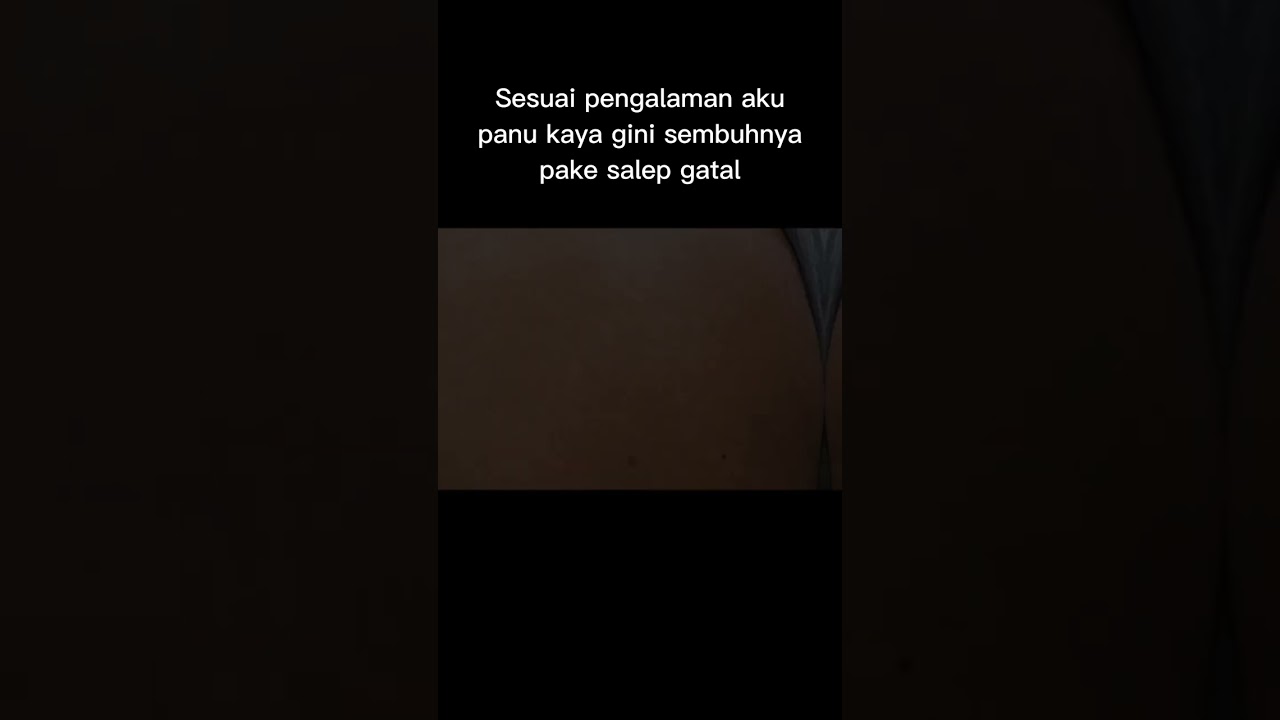 OBAT PANU PALING AMPUH