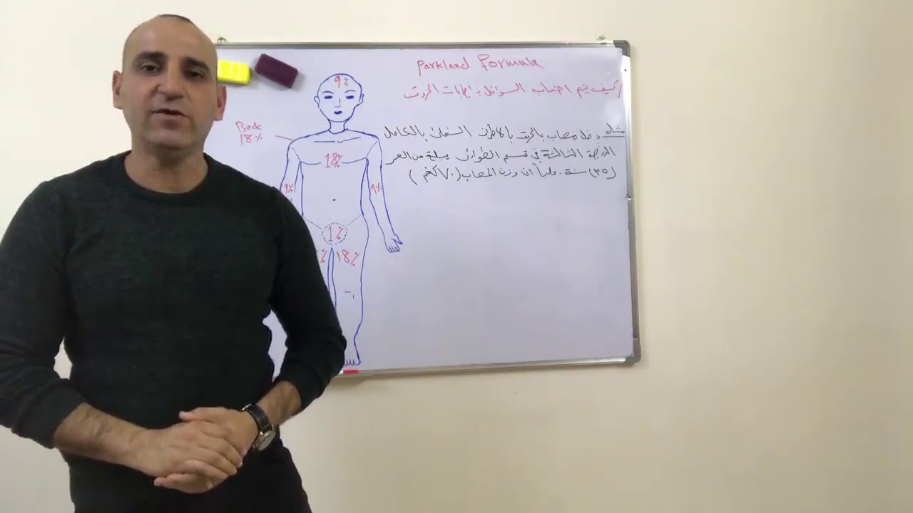 كيفيه حساب كميه السوائل الوريديه للمصاب بالحروق خلال ال 24 ساعه الاولى مع ذكر نوع المغذي