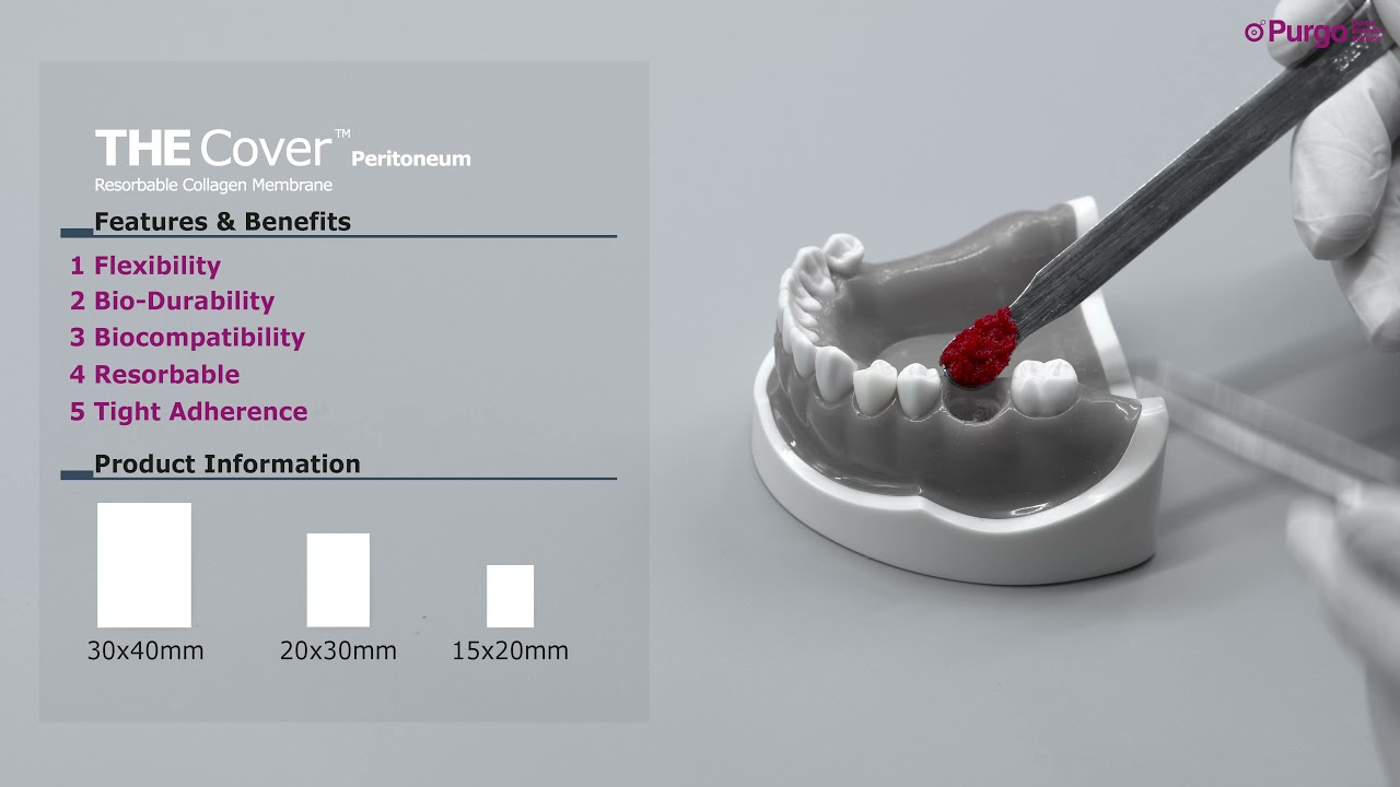 [Hands-On] THE Cover™ Peritoneum: Resorbable Collagen Membrane