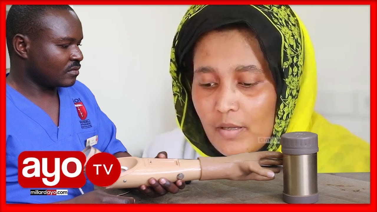 DEREVA MWANAMKE WA BASI ALIYEPATA AJALI NA KUKATIKA MKONO, MOI WAJA NA SULUHISHO LA KUMSAIDIA