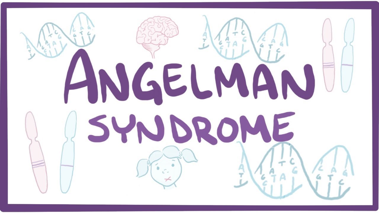 Angelman syndrome - causes, symptoms, diagnosis, treatment, pathology