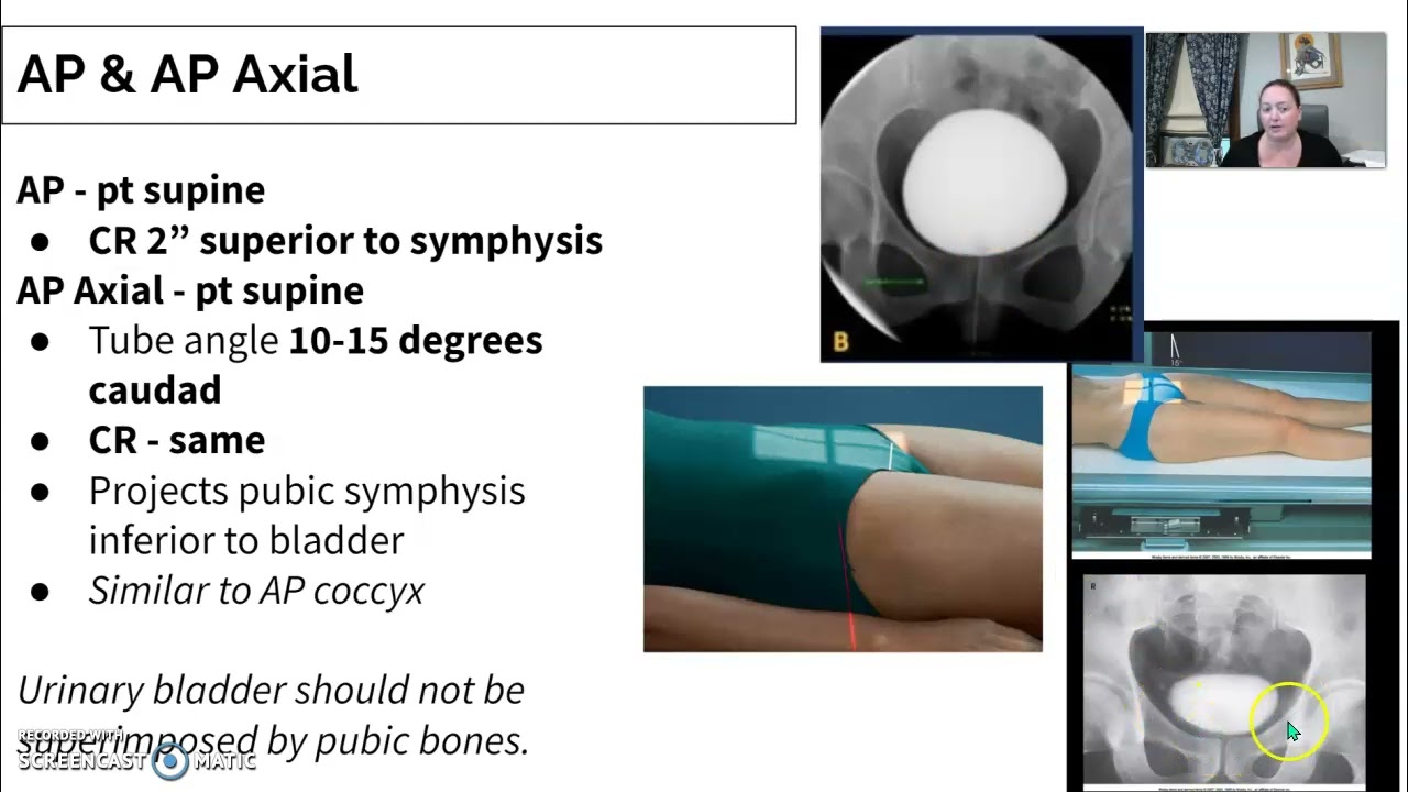 Urinary Imaging Radiology # 3 Cystogram