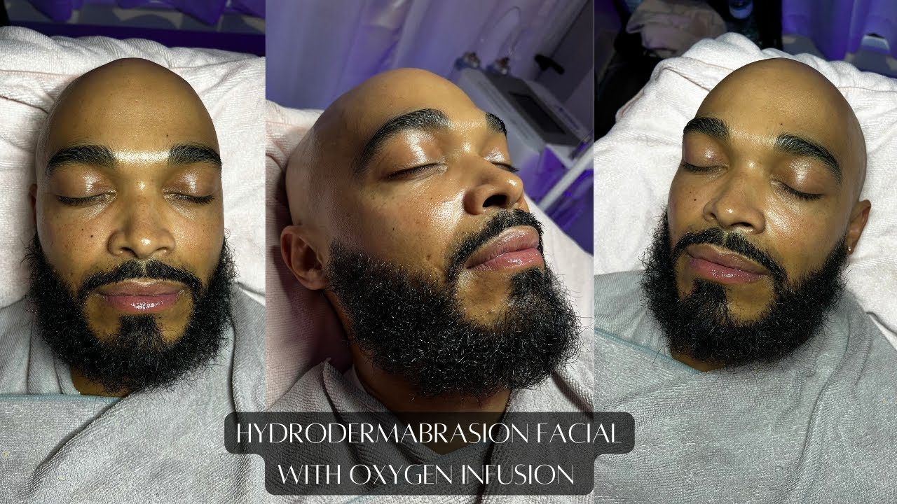 Hydrodermabrasion Facial with Oxygen Infusion feat.  @DermaJEM