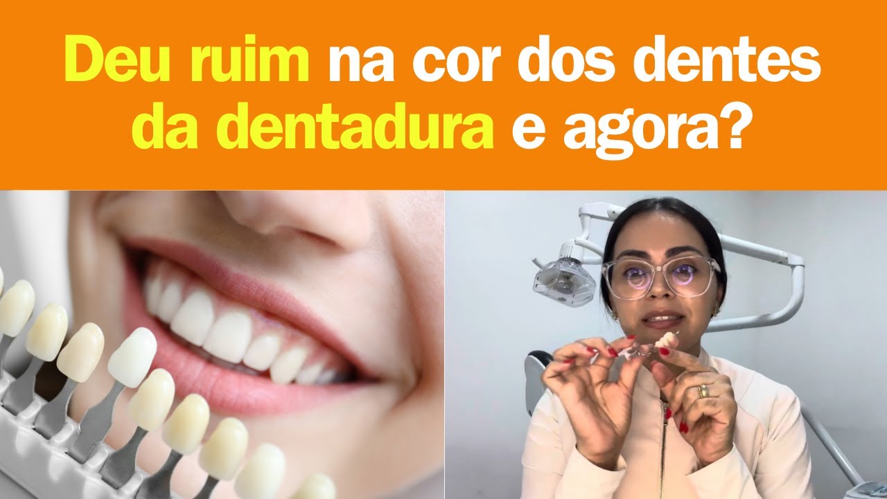 Os dentes da prótese ficaram mais brancos que os meus 😰