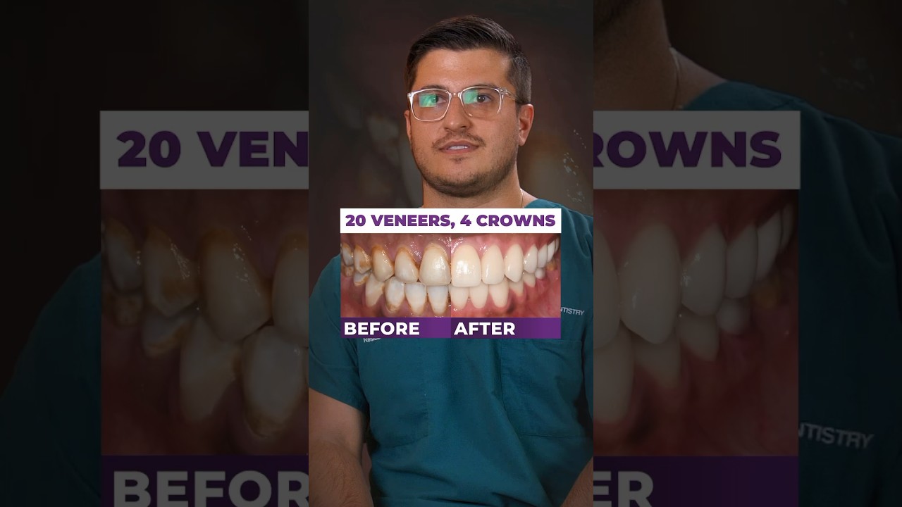 Dentist Amazed by Full Mouth Restoration! 😲 | UAB&rsquo;s Joe Molisani #shorts