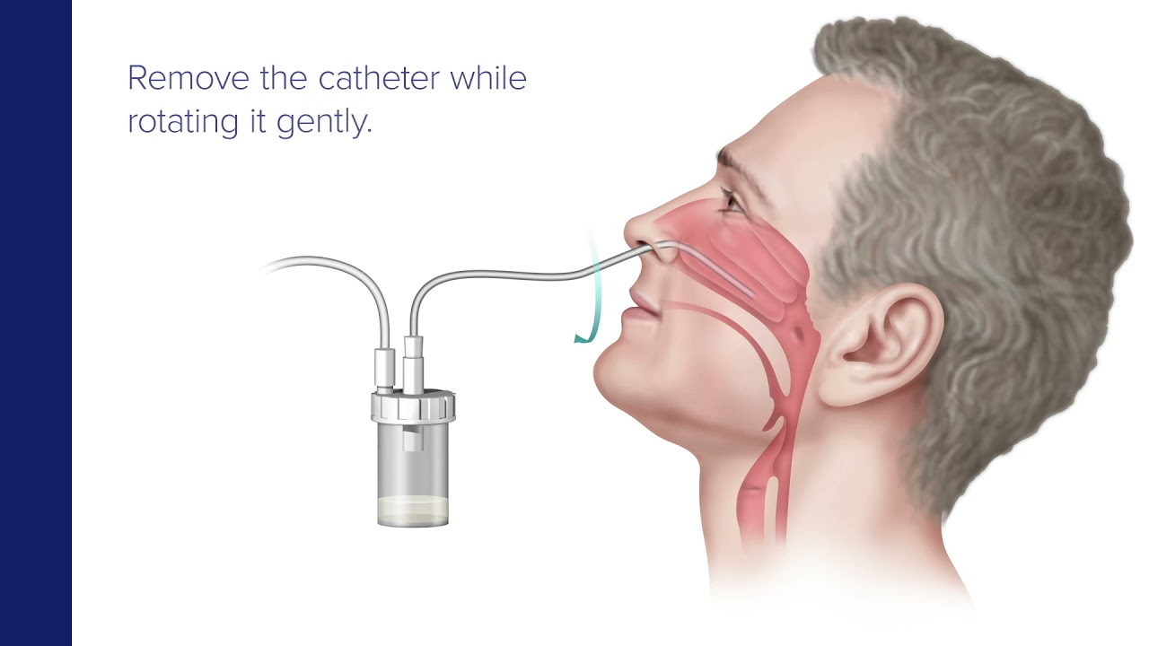 SARS-CoV-2 Clinician Collected Nasal Wash and Lower Respiratory Tract Specimen Collection Guide