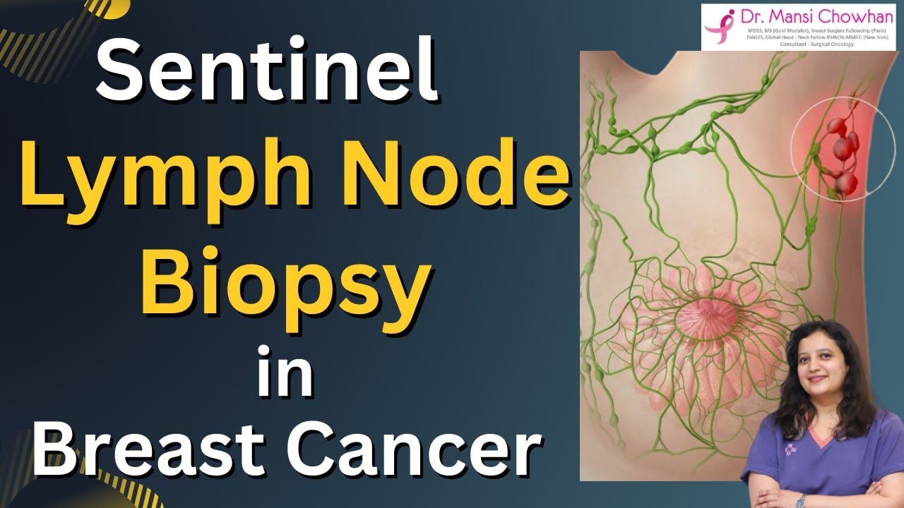What is Sentinel Lymph Node Biopsy(SLNB) in Breast Cancer - Dr. Mansi Chowhan #breastcancer #cancer