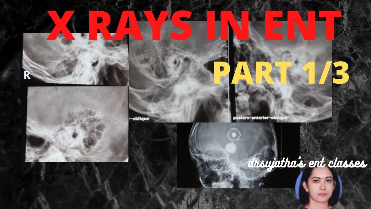 100. X ray classes for ENT  Undergraduates Part 1/3  