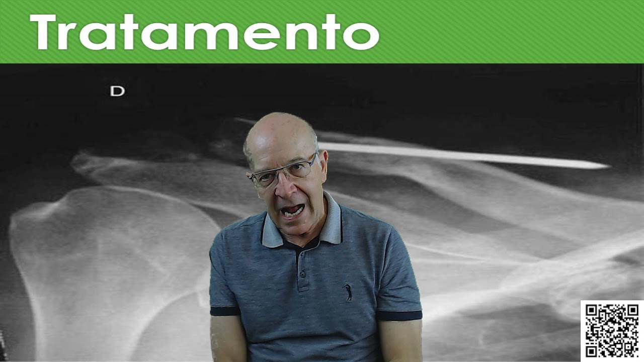 Dr. Renato Bastos - Luxação Acromioclavicular