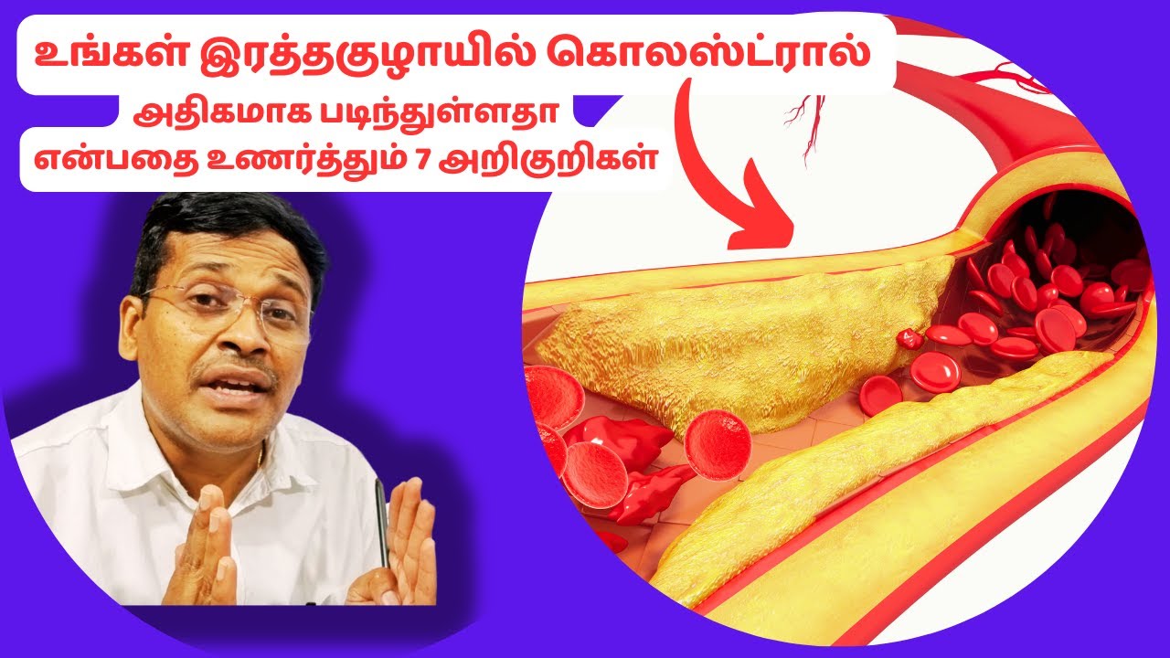 கொலஸ்ட்ரால் படிவதால் கை கால்களில் தோன்றும் 7 அறிகுறிகள் | 7 signs of cholesterol deposits in artery