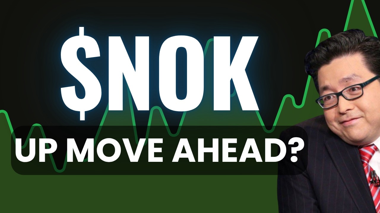 NOK Stock (Nokia stock analysis) NOK STOCK PREDICTION & analysis & news today