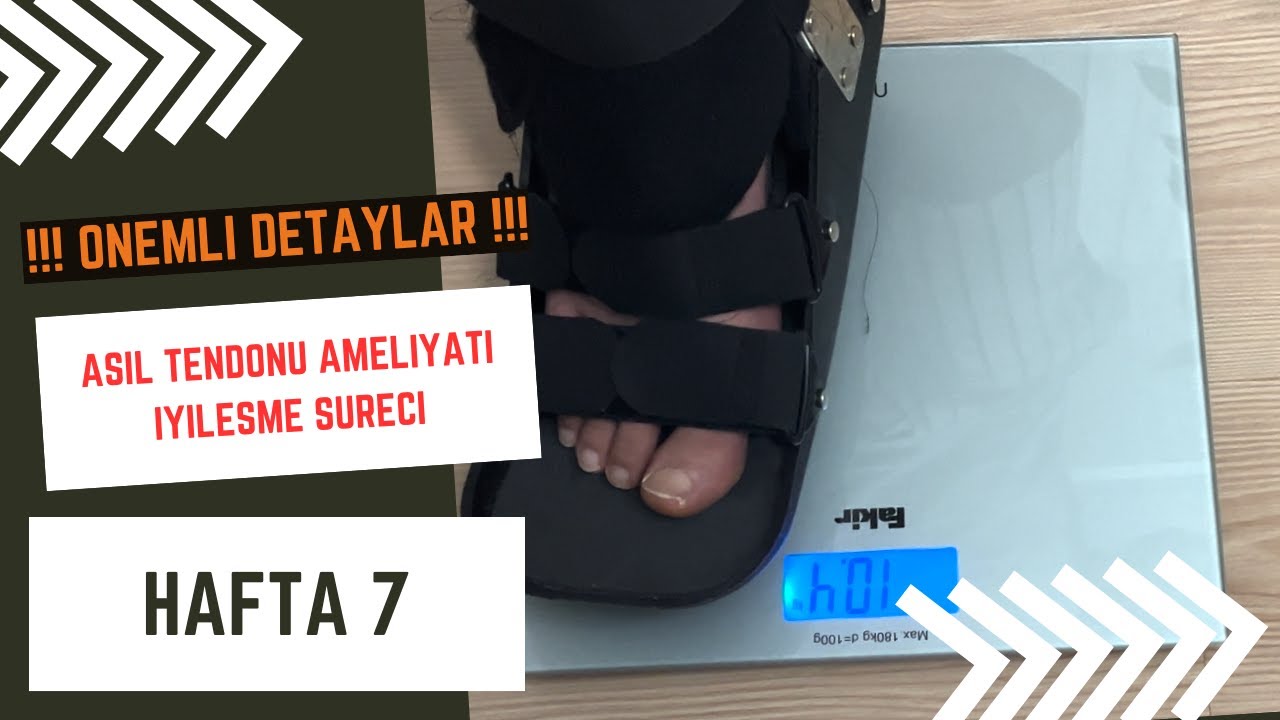 Aşil Tendonu Ameliyat Sonrası İyileşme Süreci (DETAYLI!) / 7. Hafta