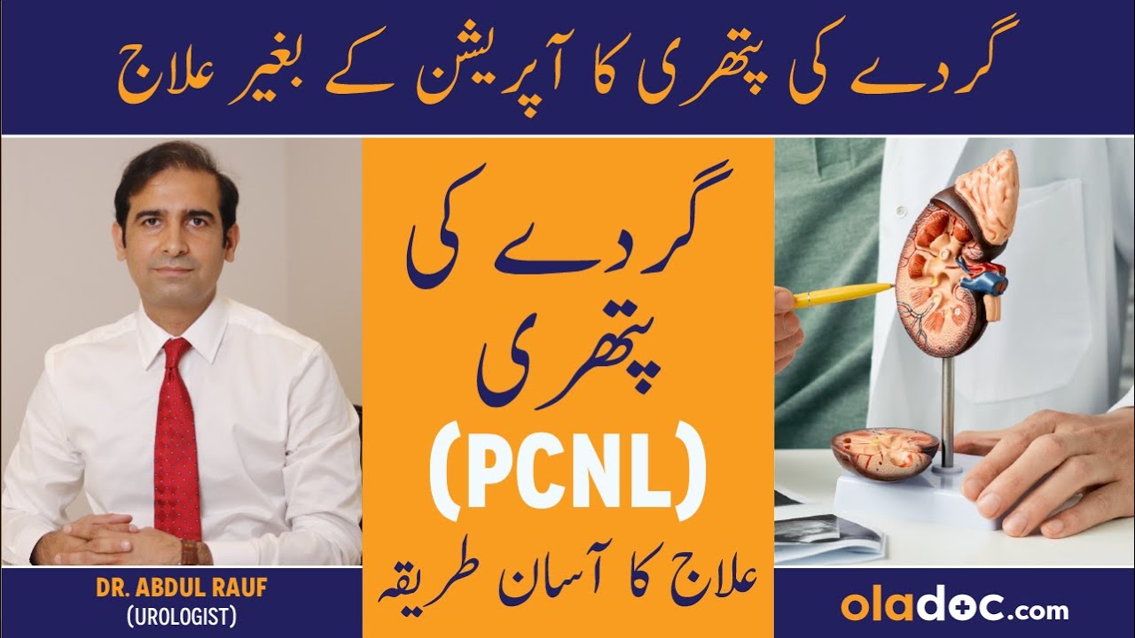 Kidney Stone Removal Urdu - Gurde Ki Pathri Ka Ilaj - Percutaneous Nephrolithotomy (PCNL) Procedure
