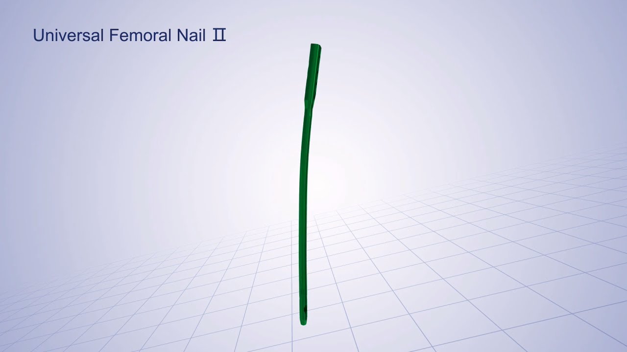 Double Medical Univeral Femoral Nail II （UFN II）