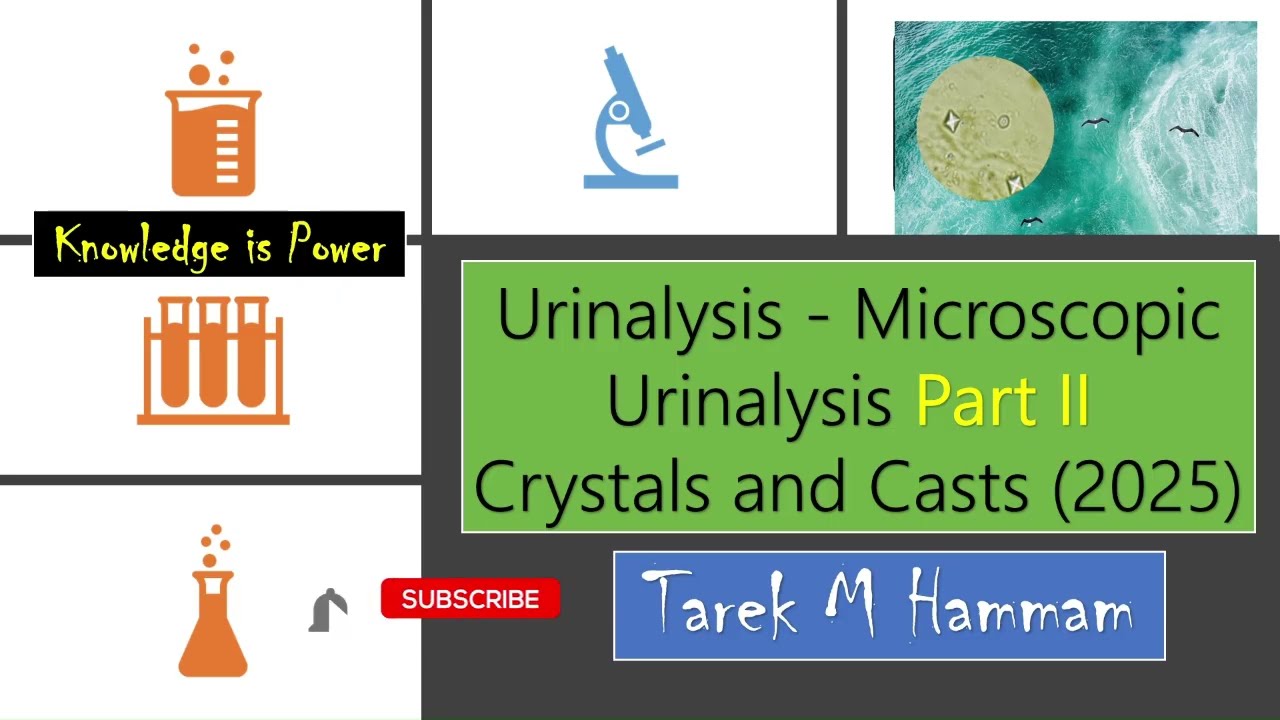 Urinalysis - Microscopic Urinalysis Part II Crystals and Casts (2025)