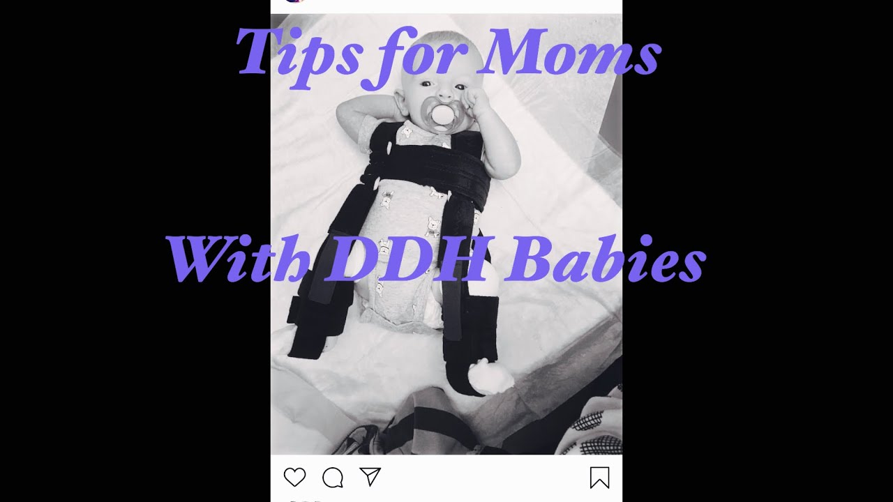 Hip Dysplasia | Pavlik Harness, Breastfeeding, Sleeping, and How to Deal ❤️❤️ DDH 🦋 CDH 🦋