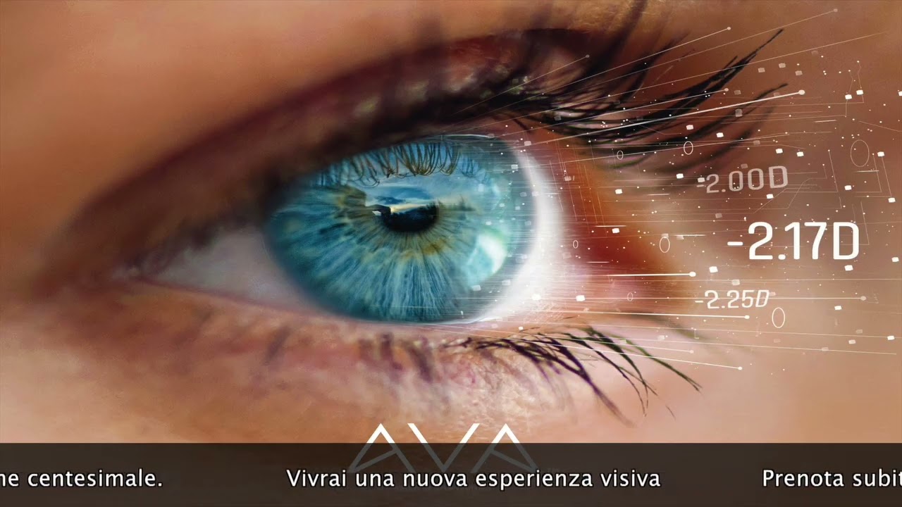 Controllo visivo del futuro