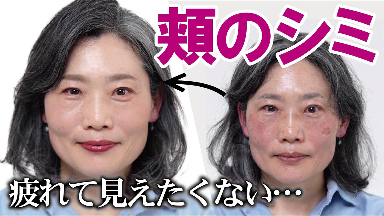 【大きく濃い頬のシミ】最強コンシーラーとチークの組み合わせは？キツく見られたくない…疲れて見えたくない…