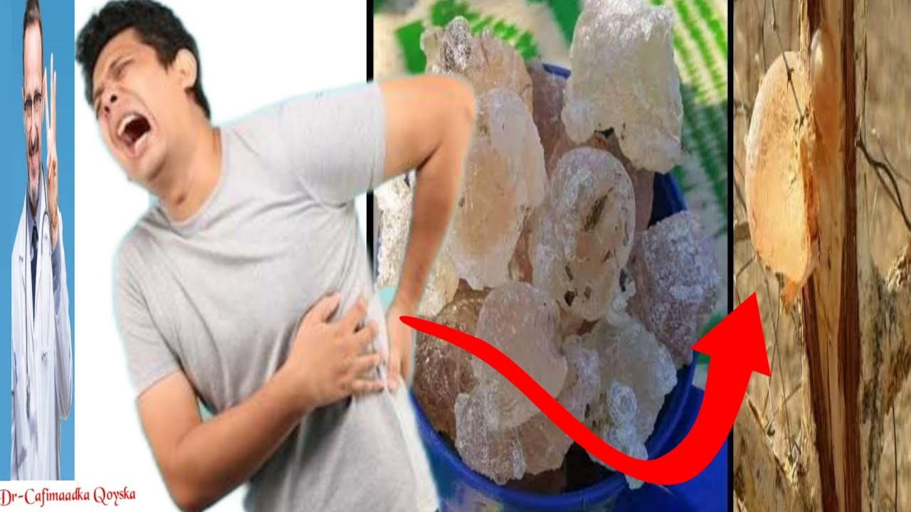 Mucjisada Cafimaad Ee Laga Helo XABAGTA CADAADA