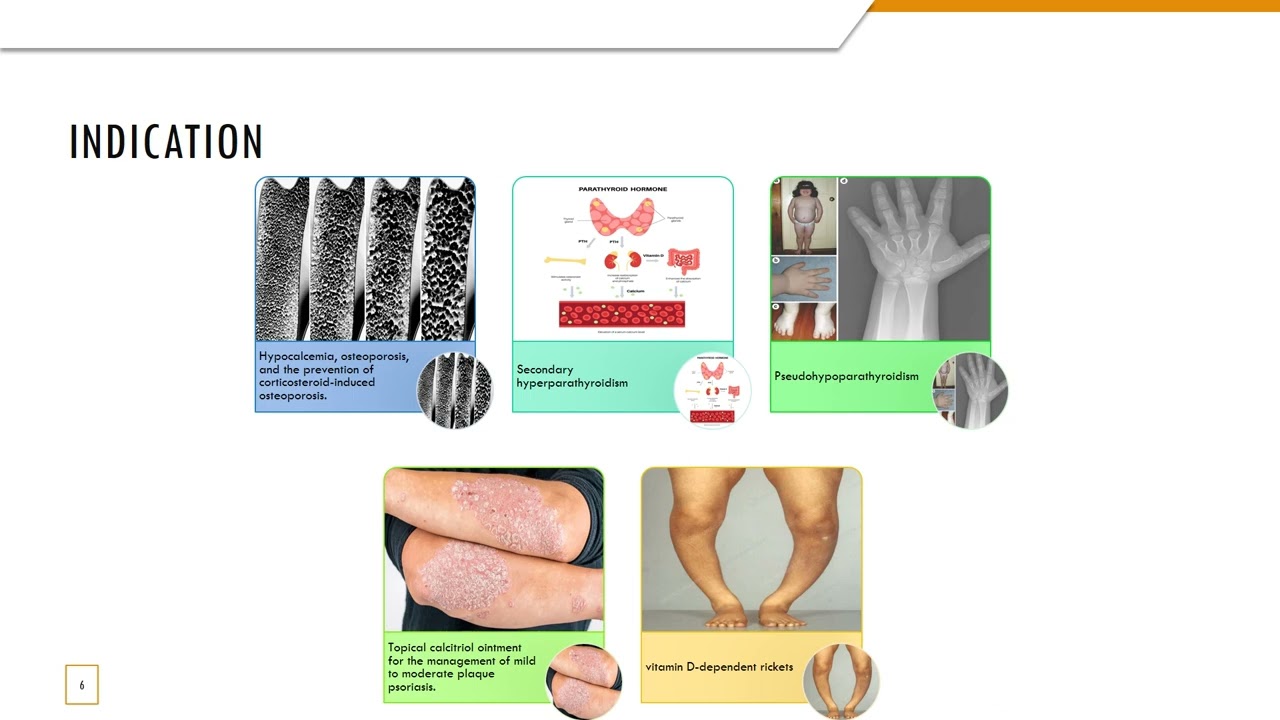 Calcitriol Drug Informational Video
