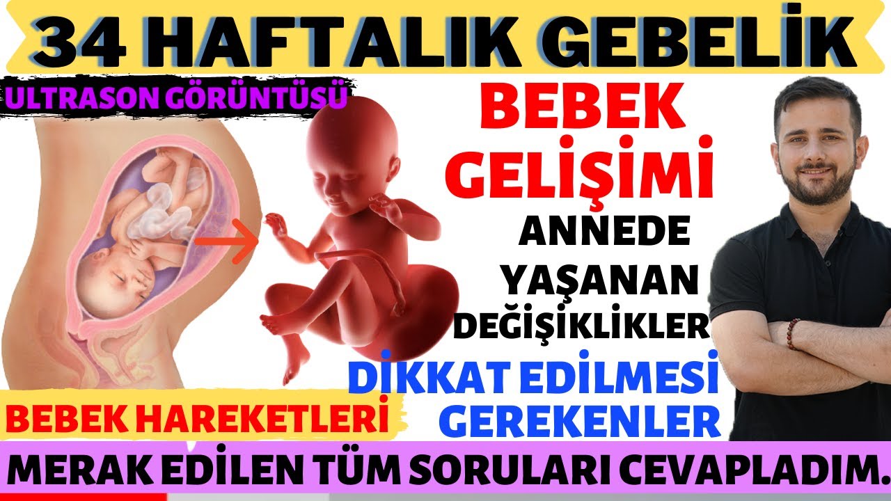 34 Еженедельно Беременность (2020)