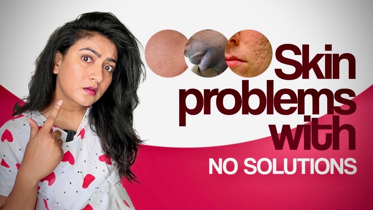 Brutally honest || పరిష్కారం లేని చర్మ సమస్యలు || Ashtrixx