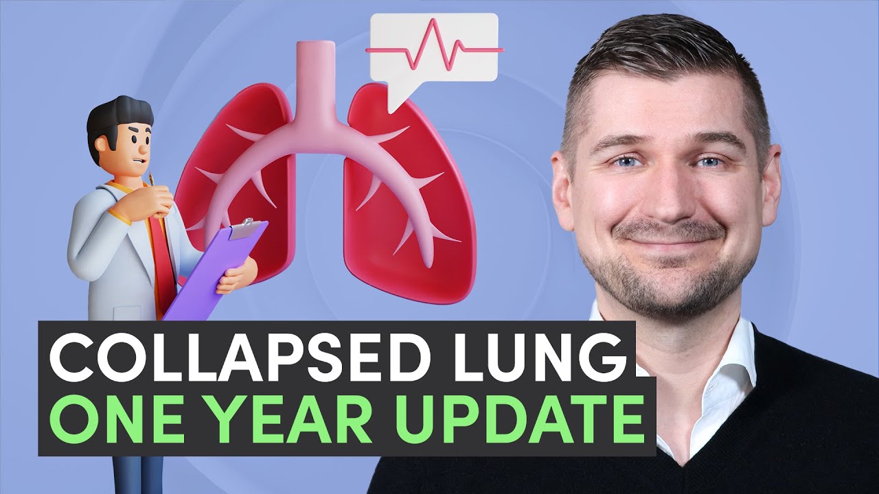 👨‍⚕️ Collapsed Lung 📅 One Year Later