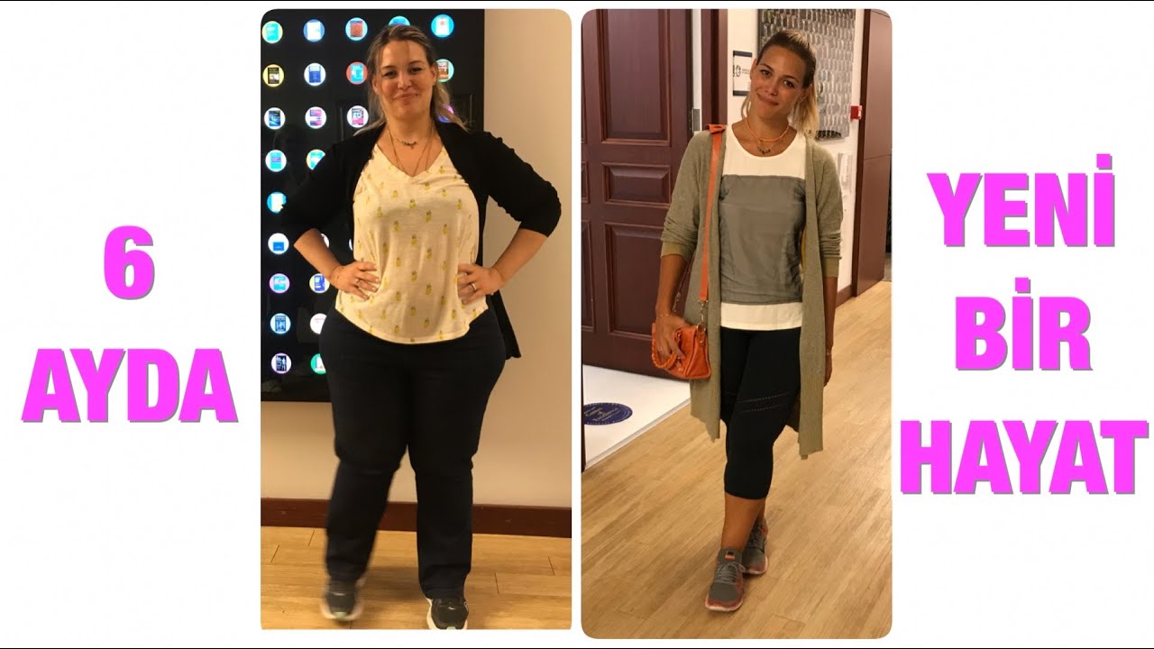 Tüp mide ameliyatı sonrası ilk 6 ay nasıl geçti, 35 kilo vermek hayatında neleri değiştirdi?