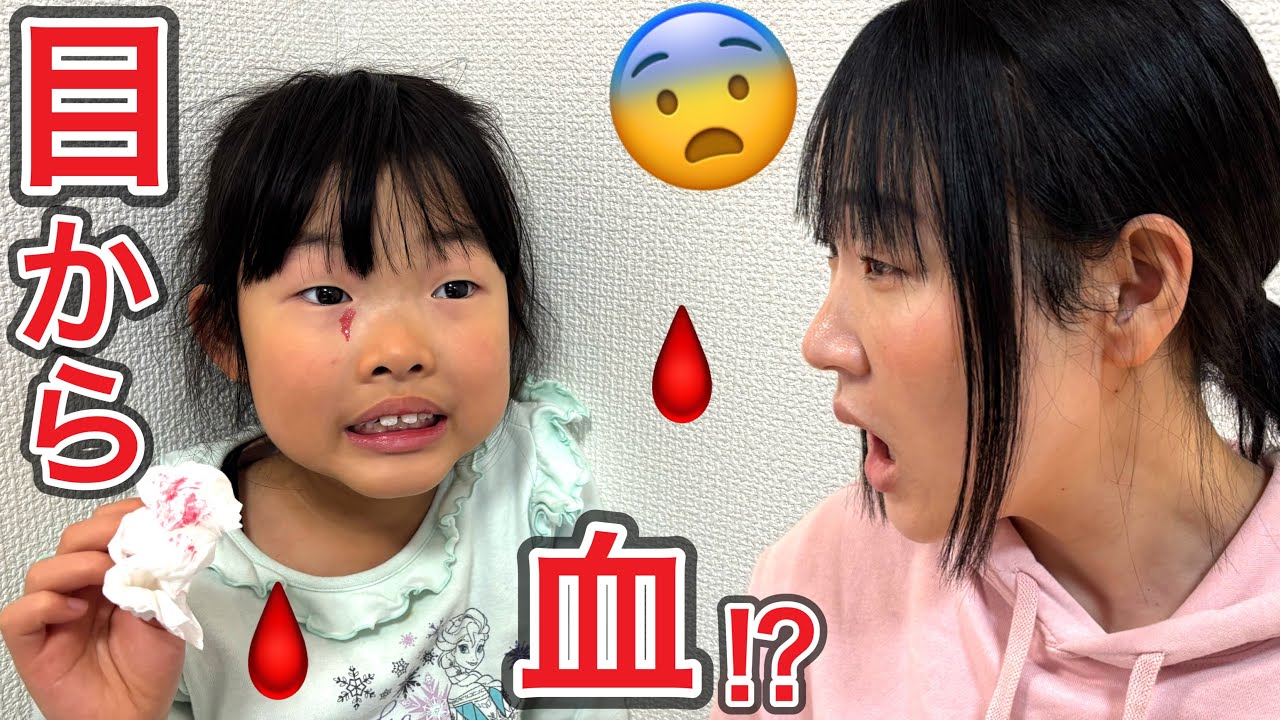 目から血が出た⁉️病院行こう…ここちゃんの目が赤くなってたので調べたら・・・・・・😨💦【実話再現】