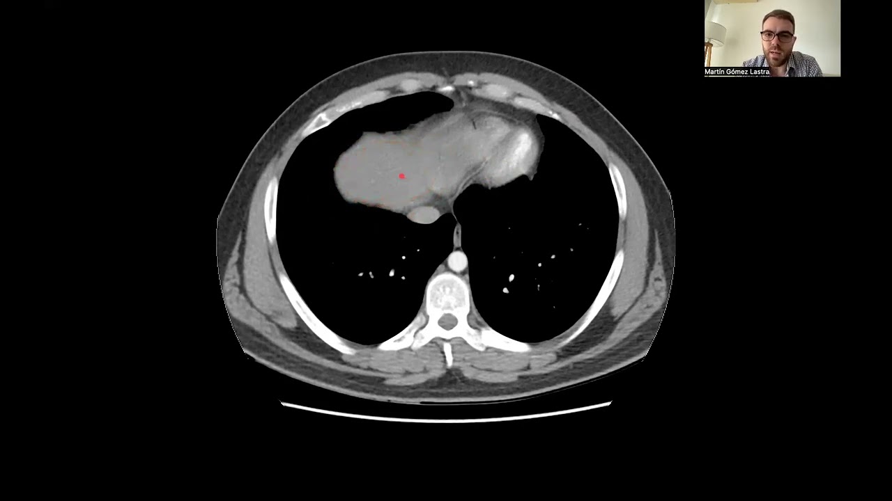DIAGNÓSTICO POR IMÁGENES DE ESPLACNO - Repaso integrador de Anatomía