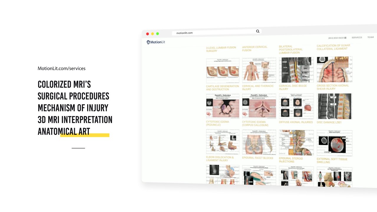 More Value&ndash;Less Cost with MotionLit Medical Library