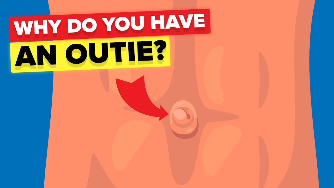 Outie Belly Button - Why Do Some People Have It?