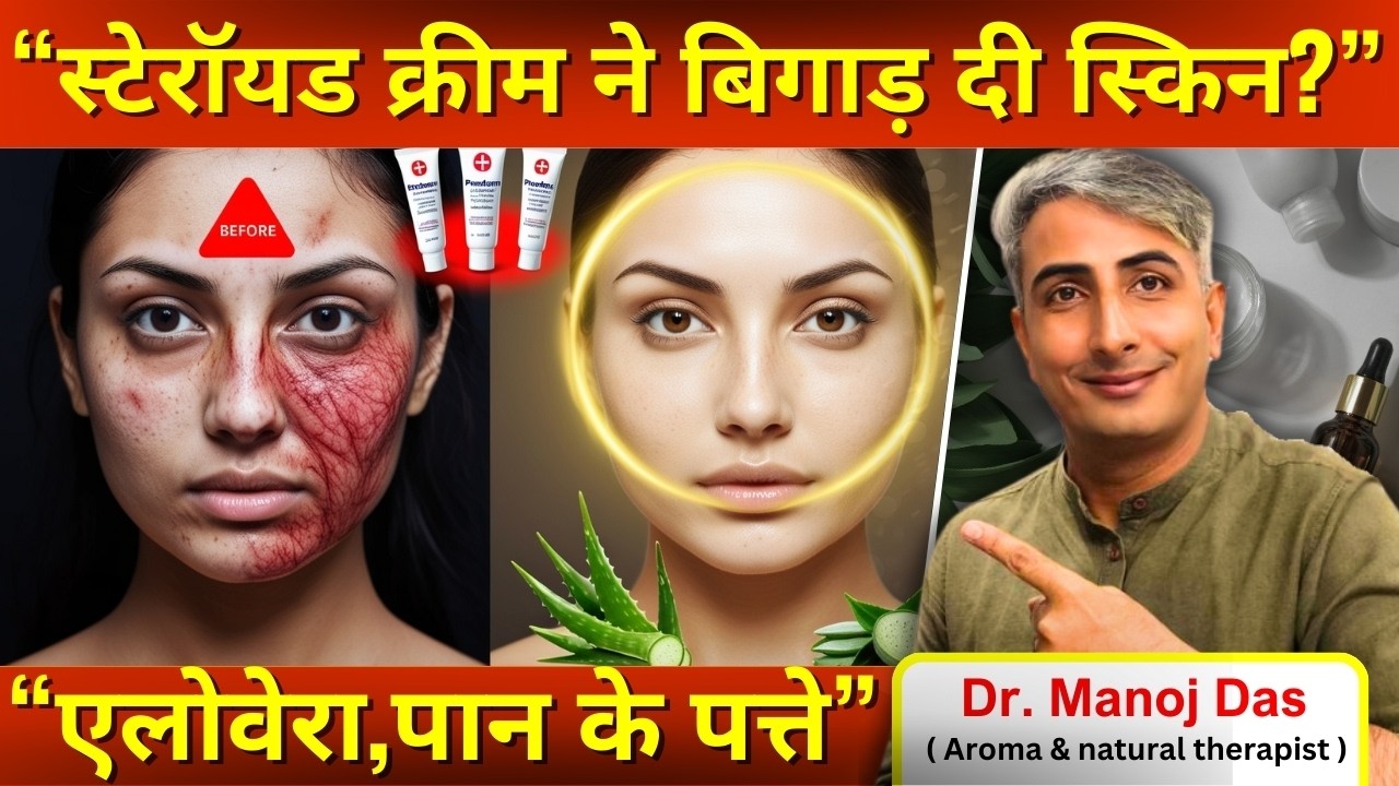 स्टेरॉयड क्रीम का कालापन I SKIN GORI KAISE KARE I HOW TO GET FAIR SKIN I DR. MANOJ DAS I #drmanojdas