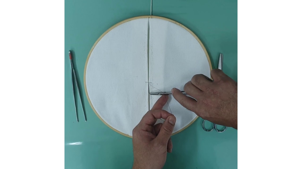 Ponto simples invertido (sutura descontínua)