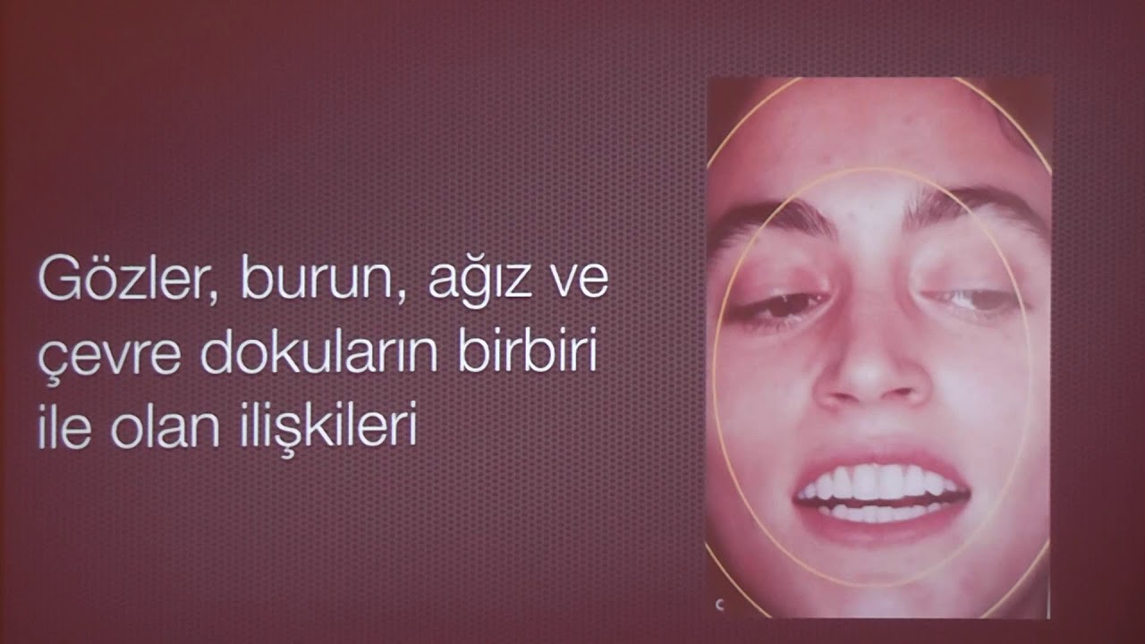 Diastema Kapama Yöntemleri - Prof. Dr. Haktan Yurdagüven - 10 Mart 2020