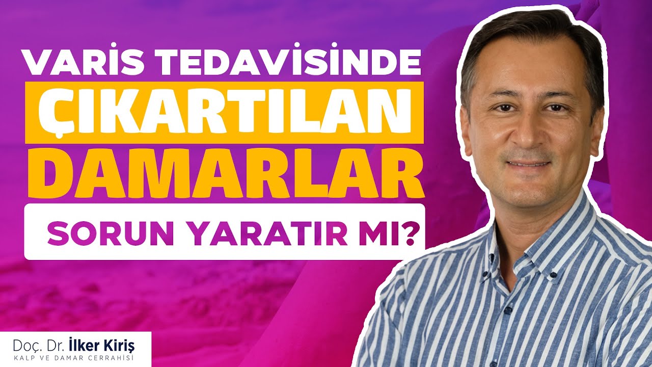 Varis Tedavisinde Çıkartılan Damarlar Sorun Yaratır mı? | Doç. Dr. İlker Kiriş