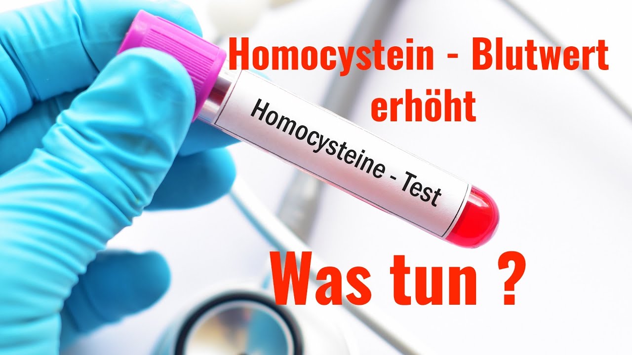 Homocystein - ein Risikofaktor für Gefäßverkalkung und Schlaganfall