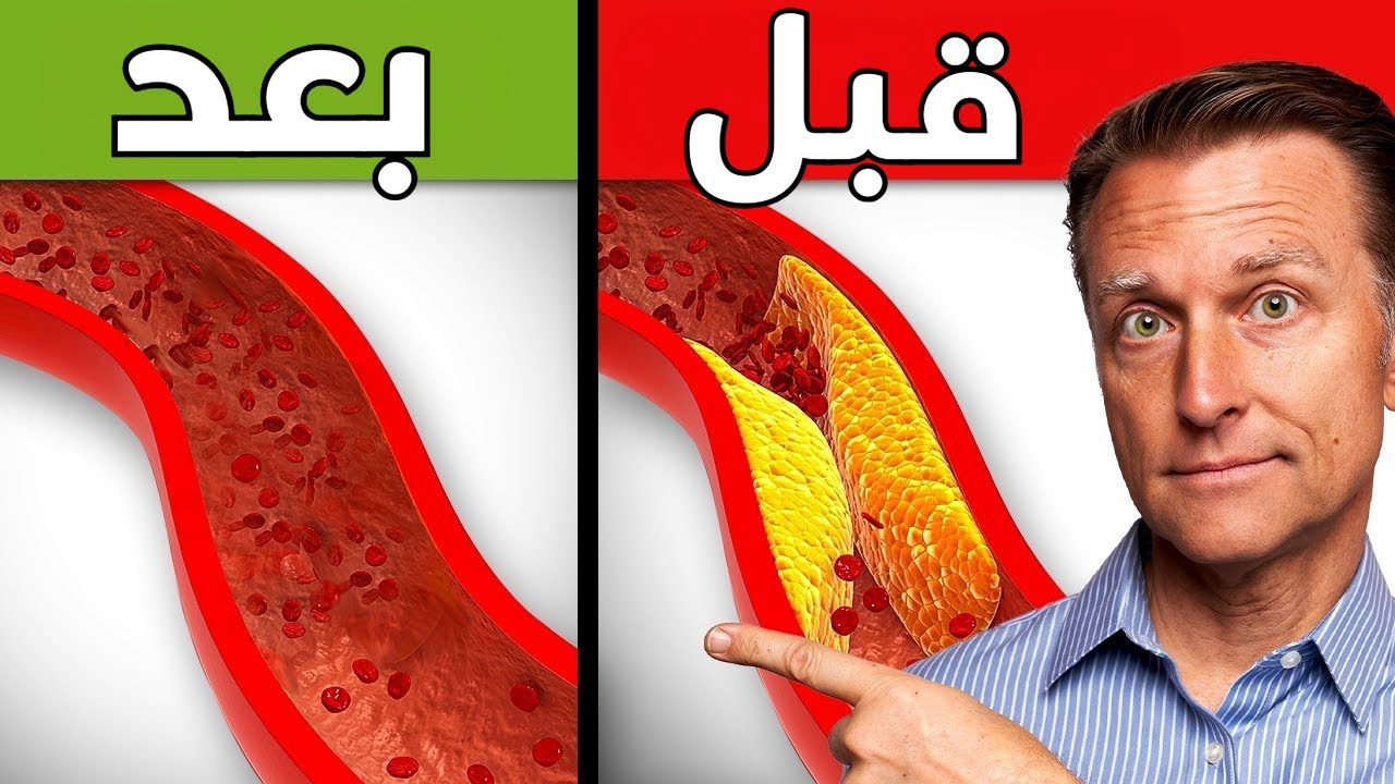 أهم غذاء لتنظيف الشرايين من الترسبات