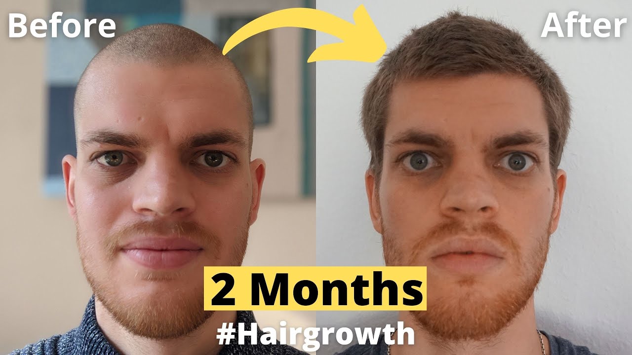 Hair Growth Time Lapse 2 Months - From Buzz Cut