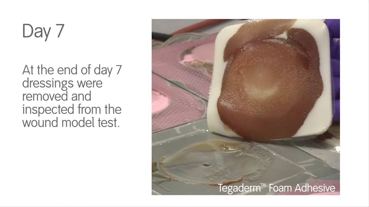 Foam Dressing Comparison   ALLEVYN Life vs TegadermTM