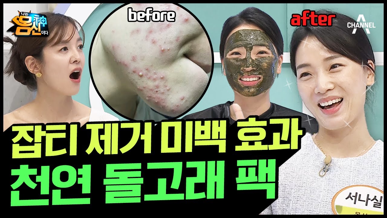 피부에 쓴 돈만 천만 원!? 다 필요 없고 '천연 돌고래 팩'만 있으면 물광 여신 | 나는 몸신이다 403 회