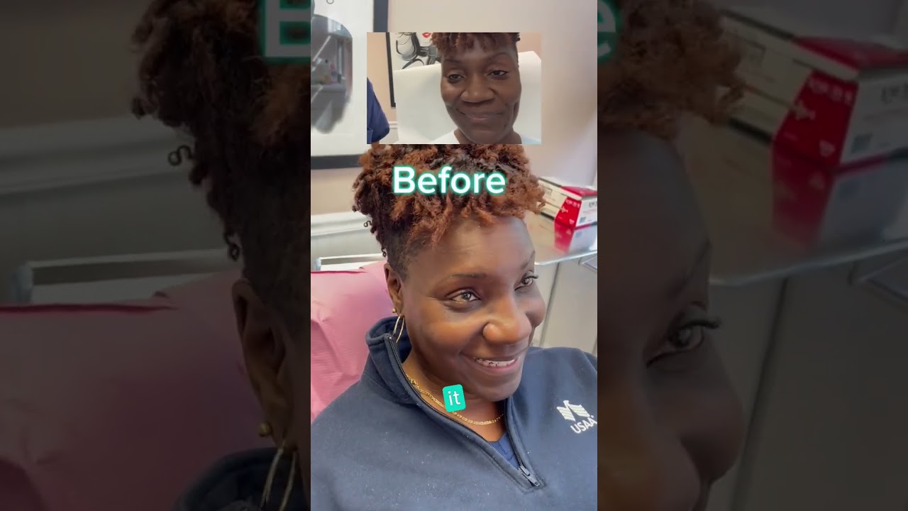 NOSE JOB REACTION - DR. TANVEER JANJUA- NEW JERSEY