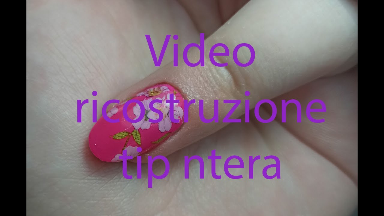 Ricostruzione con tip intera e applicazione dei foil.